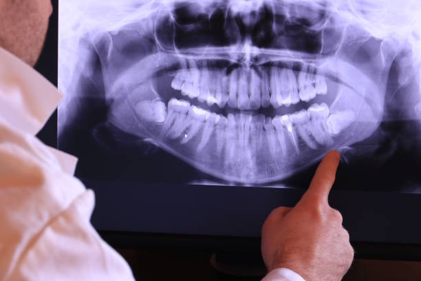 Best Emergency Dentist for Lost Fillings or Crowns in Victor, ID